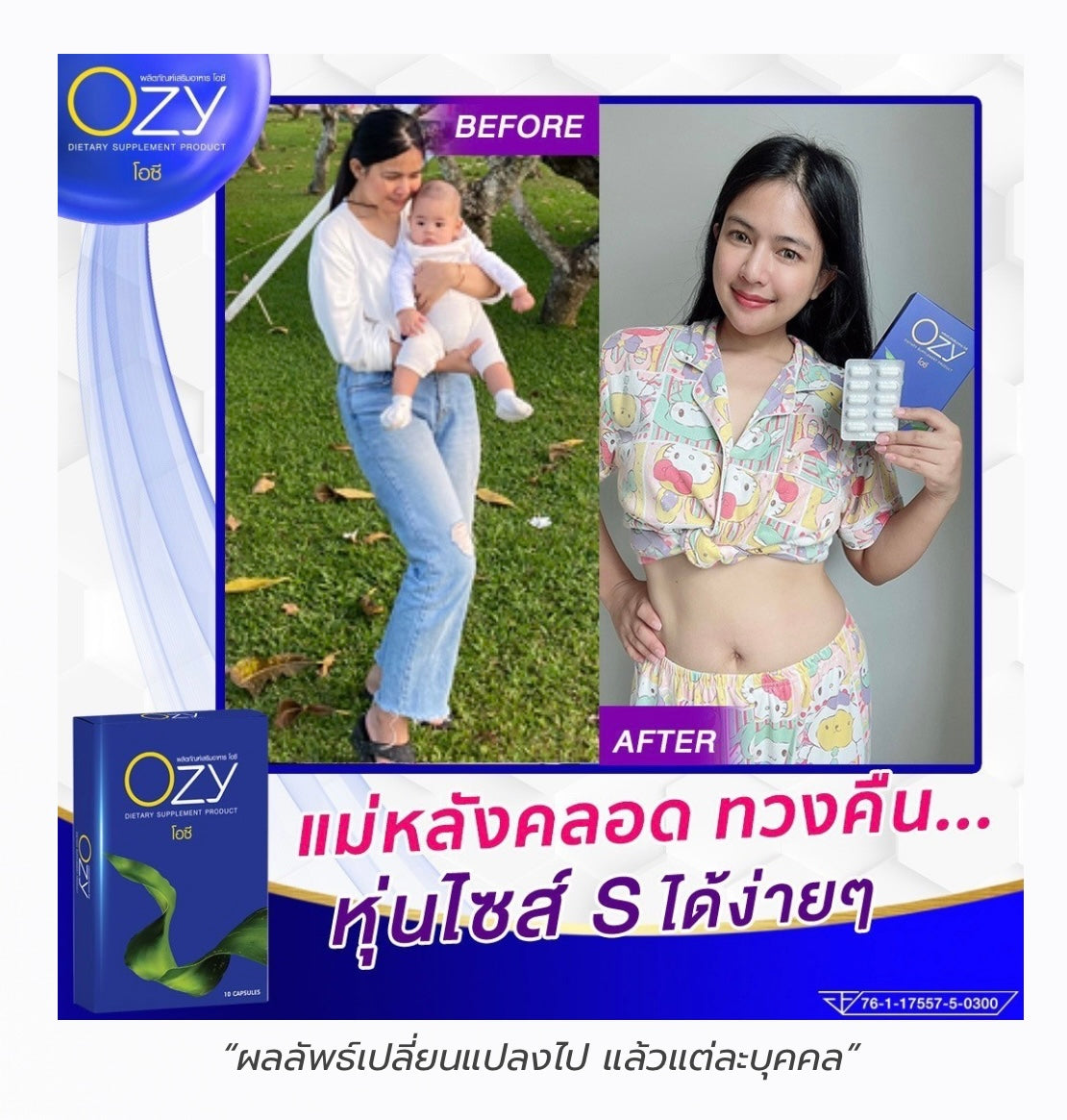 OZY หนิง รายละเอียด สินค้า คลิกที่รูปคะ
