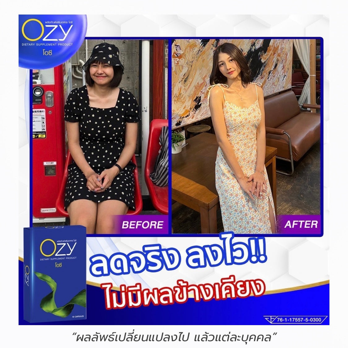 OZY หนิง รายละเอียด สินค้า คลิกที่รูปคะ