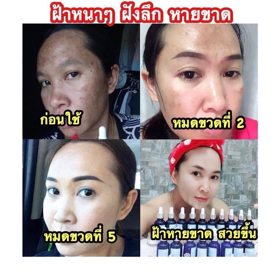 Natcha serums ทลายฝ้า 30 ml