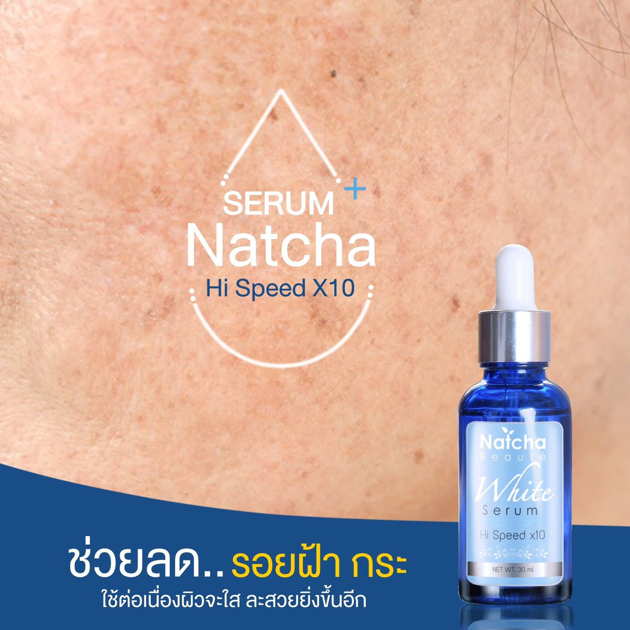 Natcha serums ทลายฝ้า 30 ml